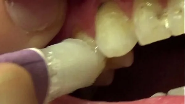 Kuumia Applying Whitening Paste To Her Filthy Teeth uutta videota